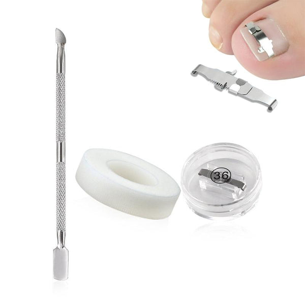 Orthopedic Buckle Toe Nail Groove Ingrown Nail Corrector, Style:No. 36, Specifications:Set