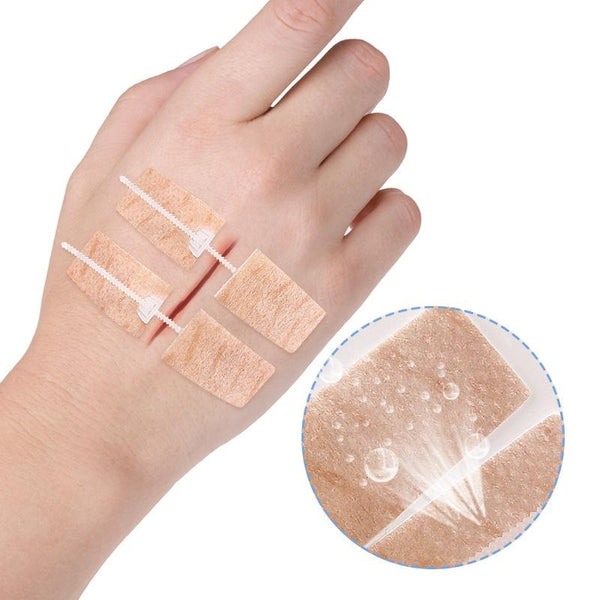 Non-woven Elastic Tape Bandage Patch Two Way Zipper Skin Latch Pull Tight Self-Adhesive Bandage Patch, Color: Skin Color 2 Buckles
