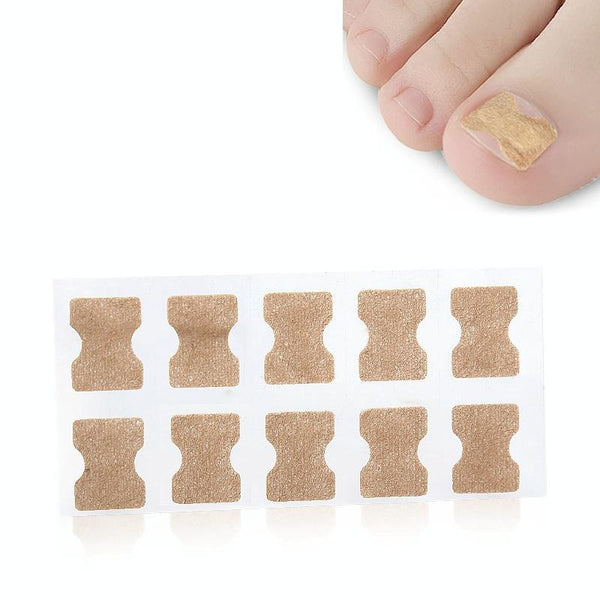 10 PCS Glue-free Orthopedic Nail Stick Toe Nail Groove Inlay Corrector(Transparent Bottom)