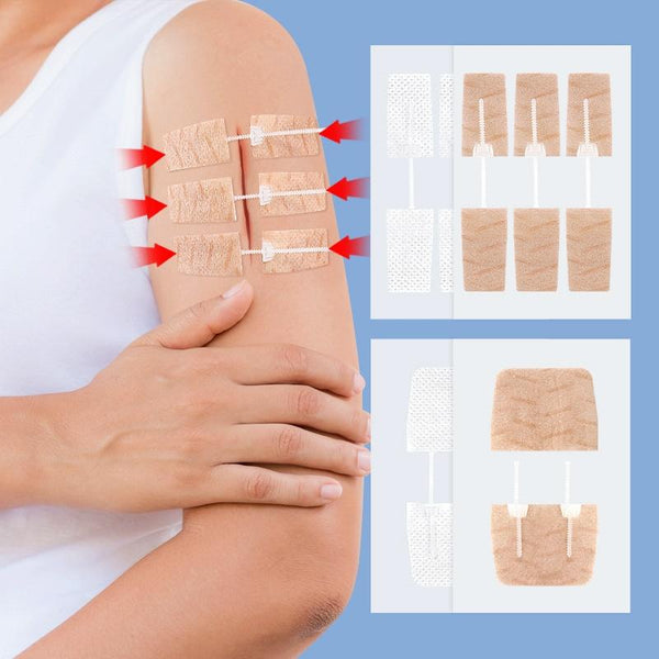 Non-woven Elastic Tape Bandage Patch Two Way Zipper Skin Latch Pull Tight Self-Adhesive Bandage Patch, Color: White 3 Buckles