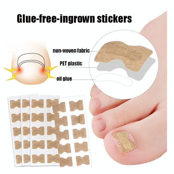 10 PCS Glue-free Orthopedic Nail Stick Toe Nail Groove Inlay Corrector(White Bottom)