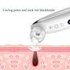 Blackhead Electric Pore Removal Machine Clean Facial Equipment,Style: Visual Model