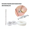 Orthopedic Buckle Toe Nail Groove Ingrown Nail Corrector, Style:No. 42, Specifications:Positive Nail Buckle
