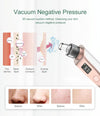 ANLAN X7 Facial Pore Cleaner Blackhead Removal Device