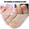 10 PCS Glue-free Orthopedic Nail Stick Toe Nail Groove Inlay Corrector(White Bottom)