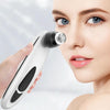 Instrument Negative Pressure Suction Portable Blackhead Instrument(White)