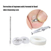 Orthopedic Buckle Toe Nail Groove Ingrown Nail Corrector, Style:No. 44, Specifications:Positive Nail Buckle