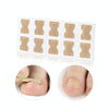 10 PCS Glue-free Orthopedic Nail Stick Toe Nail Groove Inlay Corrector(White Bottom)