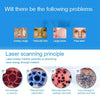 Handheld Picosecond Portable (Removing Tattoo Freckle Mole Dot)  Machine Laser Plasma Beauty Care Pen(Blue Light)