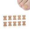10 PCS Glue-free Orthopedic Nail Stick Toe Nail Groove Inlay Corrector(White Bottom)