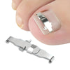 Orthopedic Buckle Toe Nail Groove Ingrown Nail Corrector, Style:No. 44, Specifications:Positive Nail Buckle