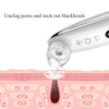 Blackhead Electric Pore Removal Machine Clean Facial Equipment,Style: Without Base