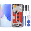 Huawei Nova 9 OLED Screen & Frame Replacement (Purple)