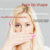 Electric Lip Plumper Device Rechargeable Lip Beauty Device(Black)