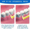 10pcs /Pack Orthodontic Teeth Interdental Brushes Dental Brace Wire Soft Bristles(Yellow)