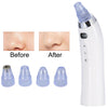 Face Pore Cleaner Blackhead Remover Vacuum Comedo Suction Diamond Dermabrasion Facial Cleaning Beauty Machine(Rose gold)