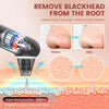 Electric Beauty Instrument Face Pore Remover Blackhead Acne Cleaner(Black)